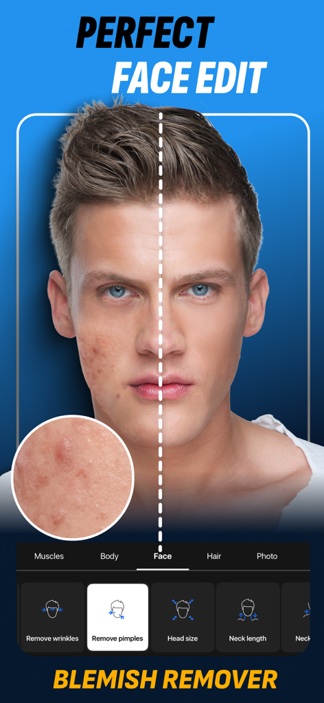 Before and after comparison of male face retouching for blemish and pimple removal