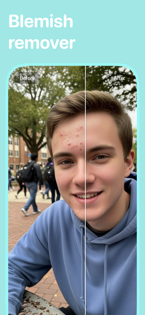Blemish Remover: Clearrr - Comparación de antes y después de la eliminación de imperfecciones en la cara de un joven