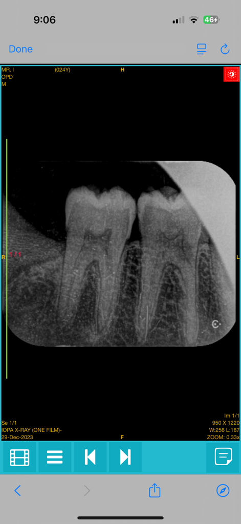 Yuvaan+ - Dental X-ray image displayed within the Yuvaan plus mobile application for remote medical viewing