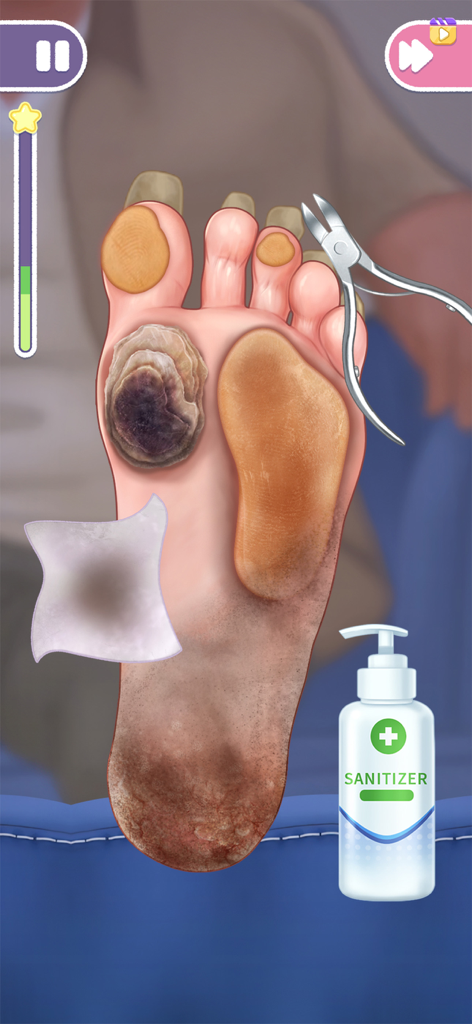 Foot treatment mini game in Skincare Time Makeover ASMR featuring nail nippers and sanitizer