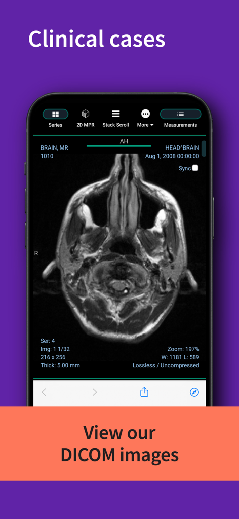Um escaneamento cerebral de RM visualizado como uma imagem DICOM na biblioteca de casos clínicos do aplicativo GE HealthCare Imaging