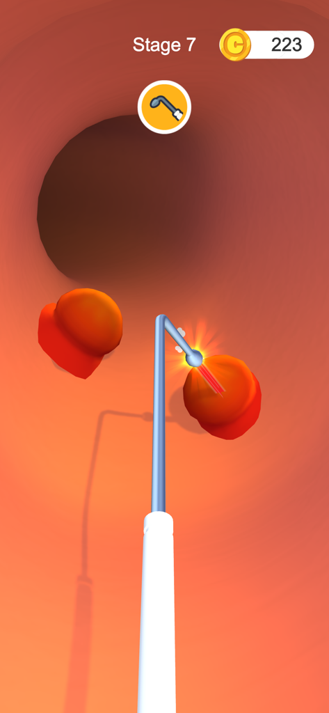 In-game screenshot of Earwax Clinic showing a medical tool removing wax from an ear canal