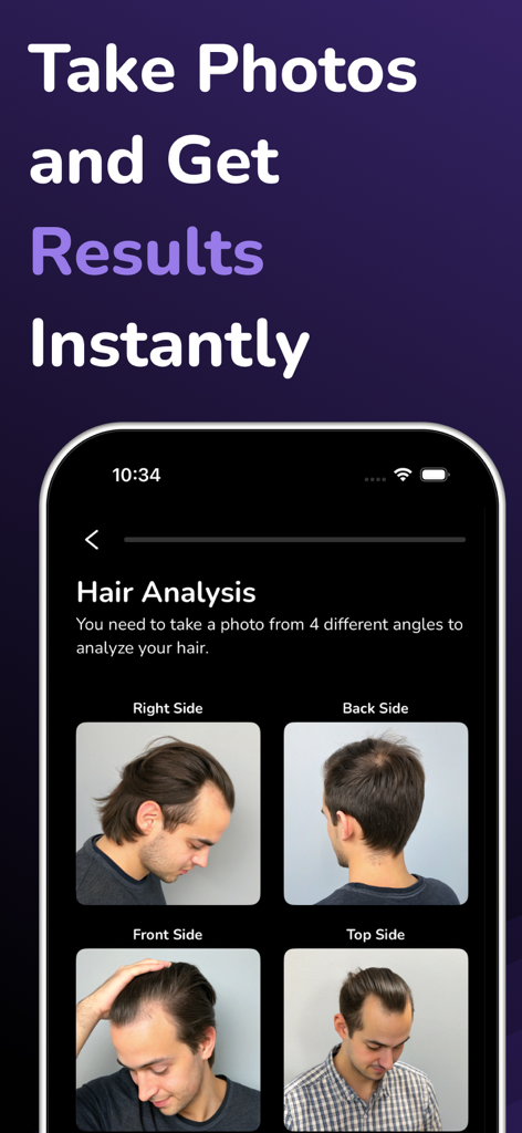 Hair Snap - AI Health & Care - Mobile app screen showing four photo angles for AI hair health analysis