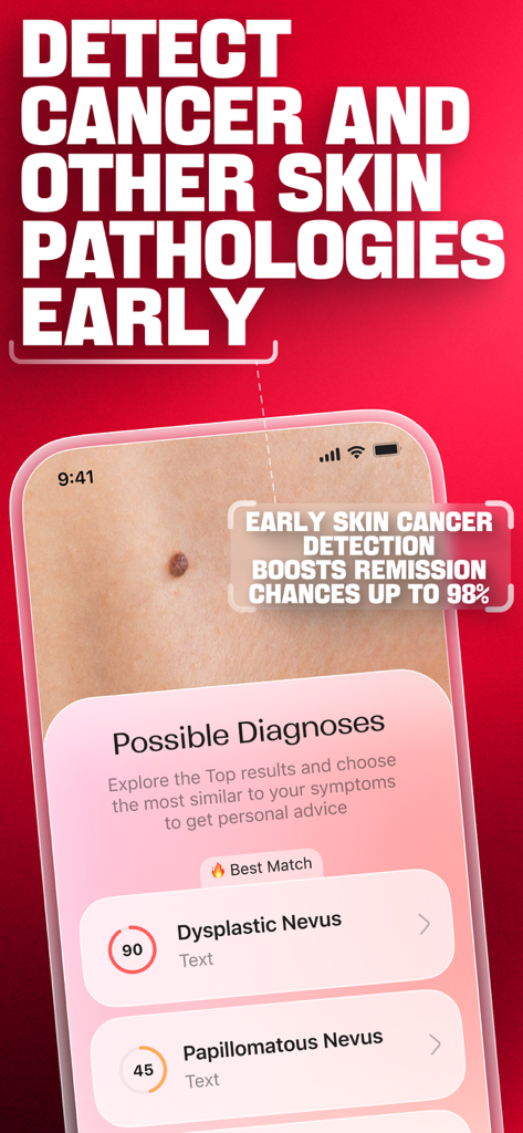 DermaScan - AI dermatologist - Interfaz de la aplicación DermaScan mostrando análisis de IA de un lunar con resultados de diagnóstico e información de detección de cáncer