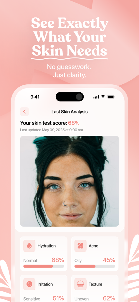 Aura - Clear Up Your Skin - Aura app skin analysis interface displaying a user's face scan with specific scores for hydration, acne, irritation, and texture