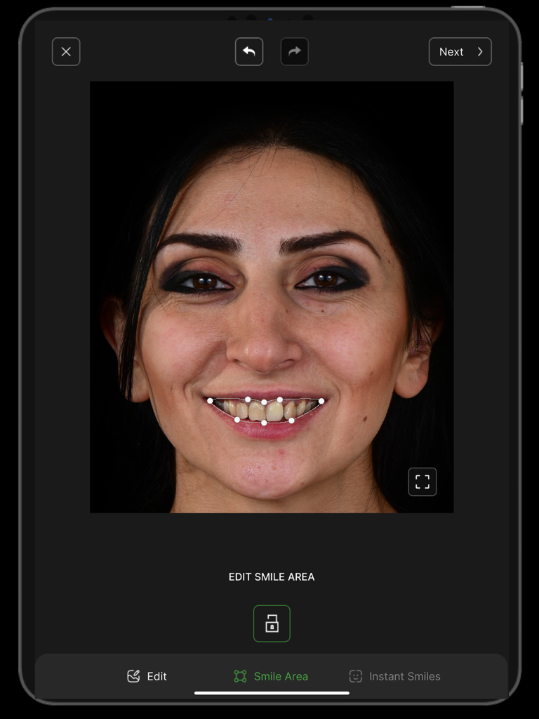 Instant Smiles - 환자 초상화에서 미소 영역 선택 도구를 보여주는 디지털 스마일 디자인 앱 인터페이스