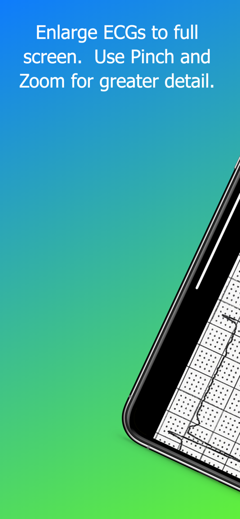 Pinch-and-Zoom-Funktion zur detaillierten Analyse von EKG-Streifen in der ECG Challenge App.