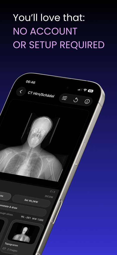 Pantalla de smartphone que muestra una tomografía computarizada de cabeza en la aplicación Visor DICOM, enfatizando que no se requiere cuenta