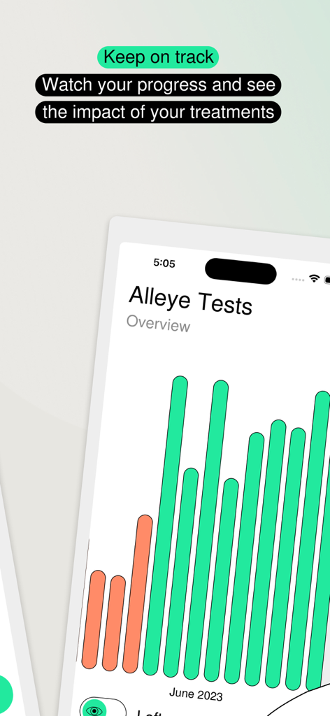 Alleye - A bar chart in the Alleye app showing vision test results and progress over time.