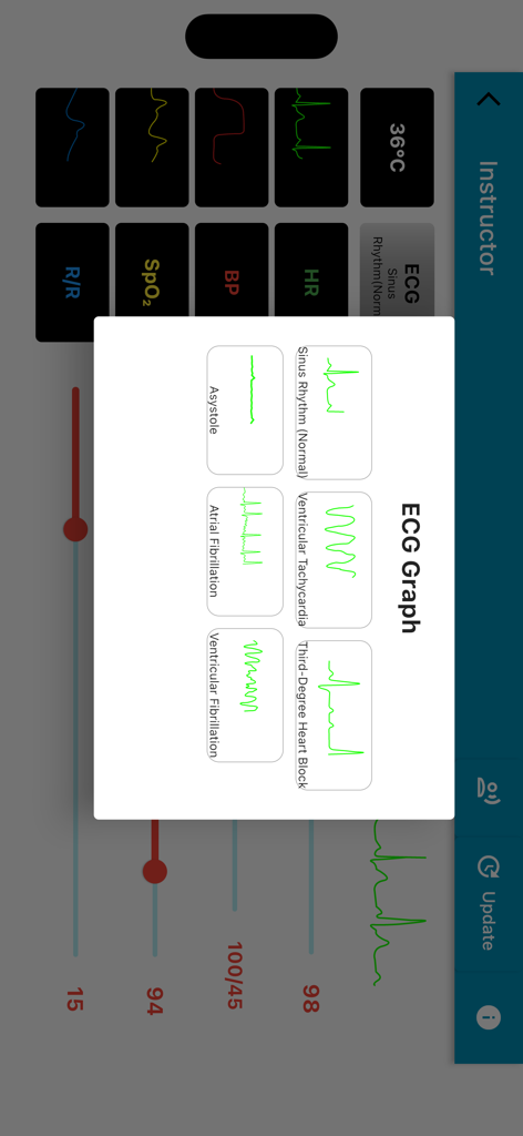 Simman - Instruktoransicht in der Simman-App, die ein Menü zur Auswahl verschiedener EKG-Rhythmen für medizinische Simulationen zeigt