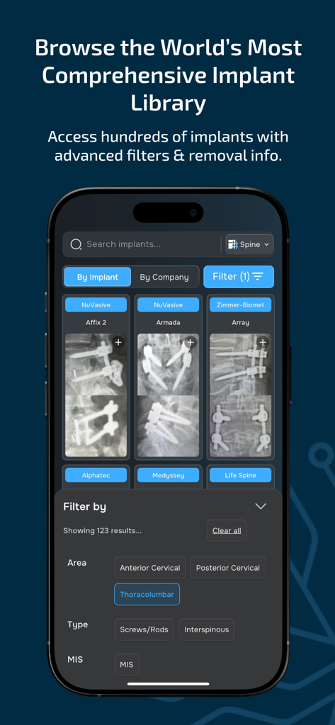 Implant Identifier - A screen from the Implant Identifier app showing the spine implant library and search filters.
