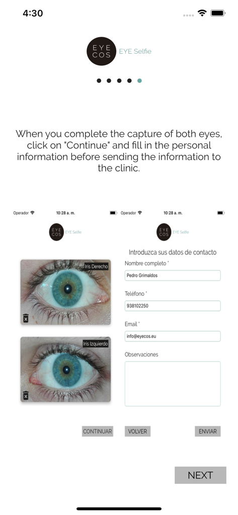 EyeCos EYE Selfie - Pantalla de la aplicación EyeCos EYE Selfie que muestra fotos oculares de alta resolución y un formulario de información personal para la presentación en la clínica