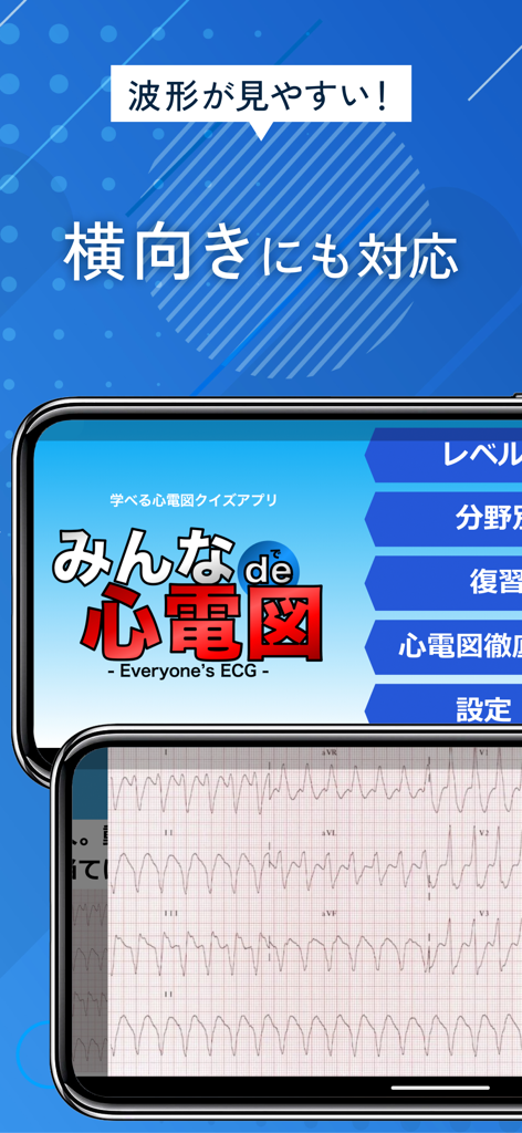 クリアな医療波形を横向き表示で表示するECG Quizアプリのインターフェース