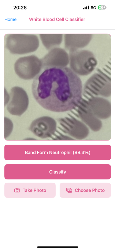 WBC Smart Lab - WBC Smart Lab app interface showing AI classification of a white blood cell as a Band Form Neutrophil
