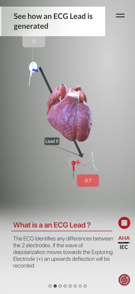 A 3D anatomical heart model demonstrating how an ECG lead is generated using electrodes.