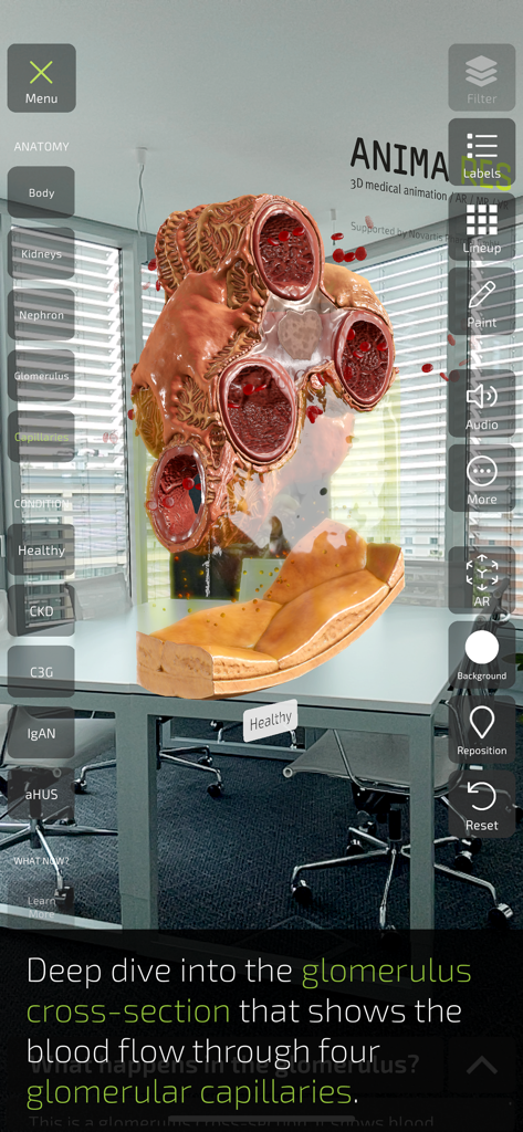 INSIGHT KIDNEY - An augmented reality 3D model of a kidney glomerulus cross-section showing blood flow through capillaries in a room setting.