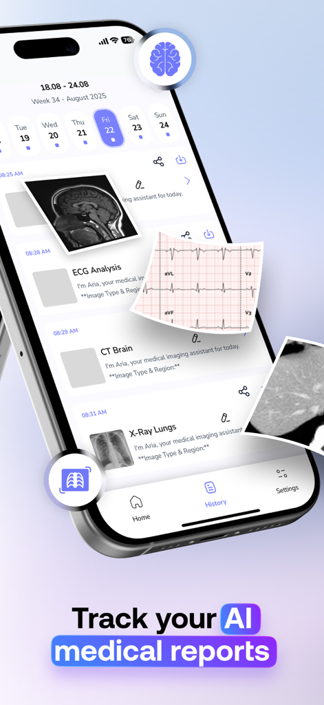 AI Doctor & Radiology-Med Scan - A smartphone displaying the history tab of the MedScan AI app with various medical imaging reports like ECG, CT brain, and X-ray lungs