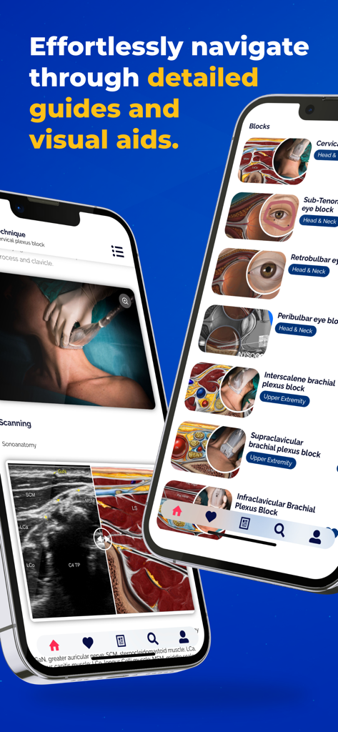 NYSORA Nerve Blocks app interface showing detailed ultrasound guided procedures and anatomical visual aids on two smartphones