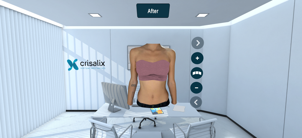 Crisalix VR - Crisalix VR 3D simulation showing the after result of a plastic surgery procedure in a virtual clinic setting.