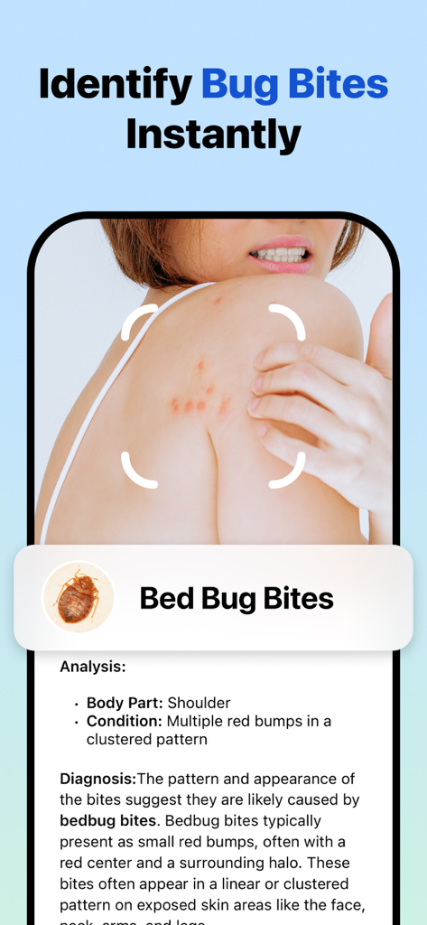 A smartphone screen from the Picture Insect app showing an identification result for bed bug bites on a person's shoulder.