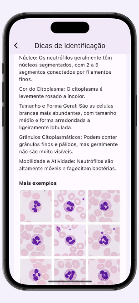 Leucogram | wbc counter - Guía de identificación de glóbulos blancos que muestra características de neutrófilos e imágenes microscópicas.