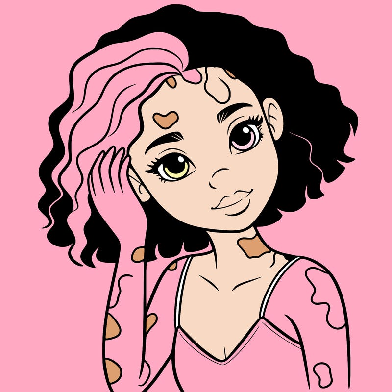 vitiligo black girl