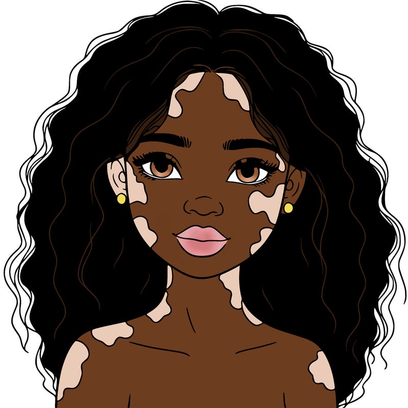 beautiful black girl with vitiligo