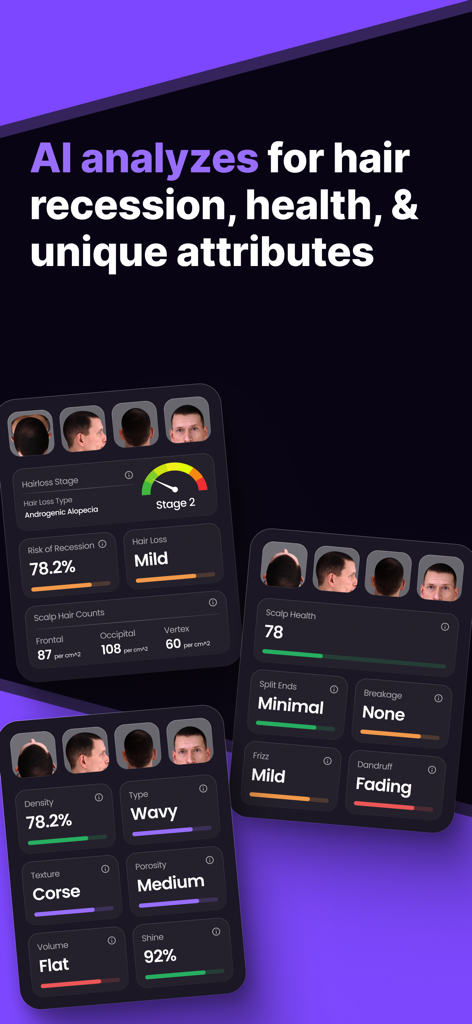 AI hair health analysis report showing recession risk and hair attributes
