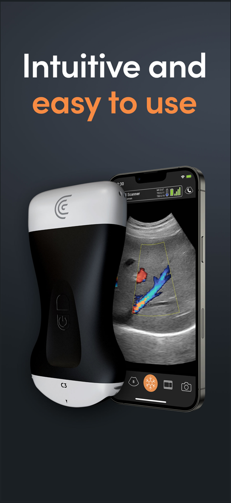 Un scanner d'échographie sans fil Clarius à côté d'un smartphone affichant un examen d'imagerie médicale sur l'interface de l'application