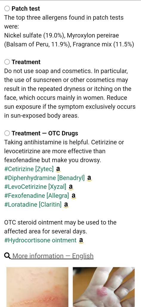 Model Dermatol - Wiki - Screenshot of the Model Dermatol Wiki app showing patch test results and over the counter treatment options for skin conditions