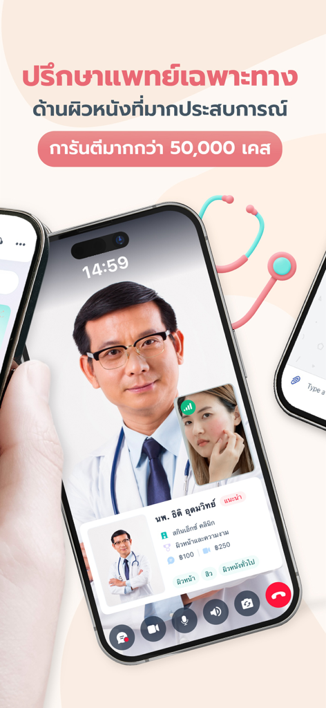 Un smartphone mostrando una videollamada en vivo entre un dermatólogo y un paciente en la aplicación SkinX