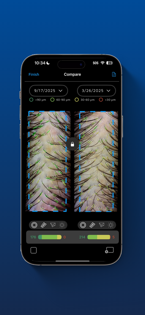 A mobile interface showing a side by side comparison of microscopic hair analysis results with AI driven metrics