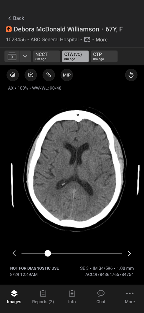 Aidoc - Interface móvel do aplicativo Aidoc exibindo uma tomografia computadorizada axial do cérebro do paciente para revisão clínica