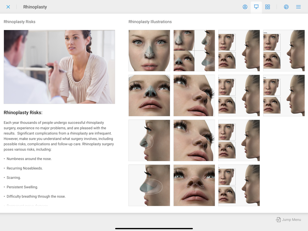 TouchMD Consult - for Staff - A medical consultation screen showing rhinoplasty risks and surgical illustrations for patient education