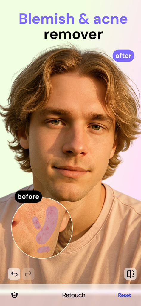 FaceAI・Face & Makeup AI Editor - Before and after comparison of AI blemish and acne removal on a man face