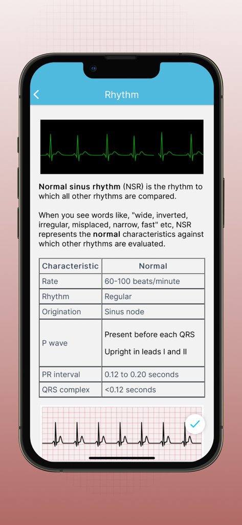 ECG EKG Interpretation Mastery - Educational screen showing normal sinus rhythm characteristics table and EKG strips