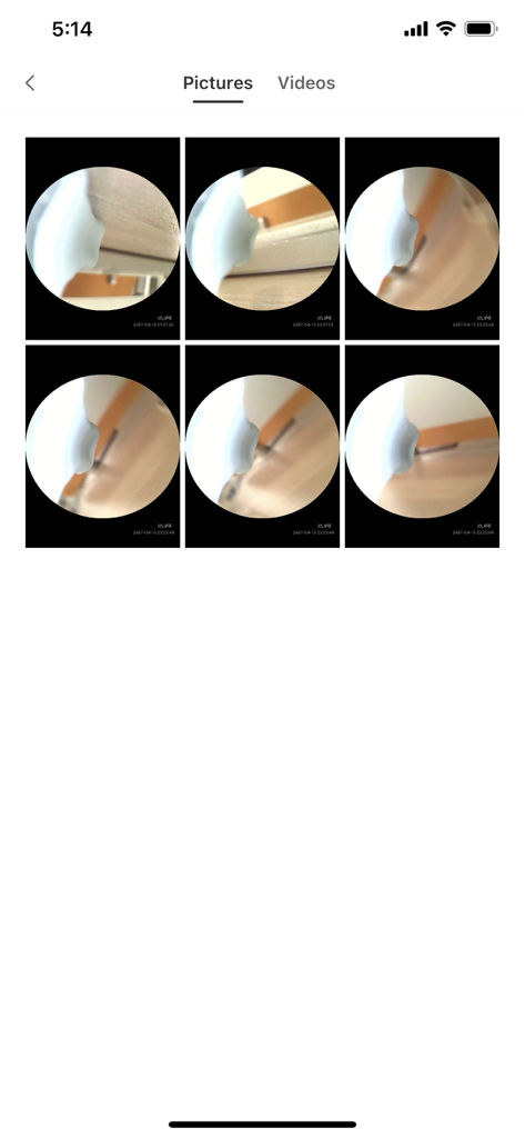 Xlife - Xlifeアプリのギャラリー画面。スマート耳鏡またはスキンカメラからキャプチャされた写真が表示されています