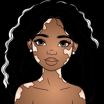 beautiful black girl with vitiligo