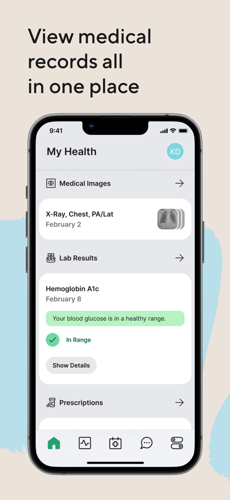 Smartphone screen showing the My Health section of the Carby Health app with medical records lab results and X-ray images