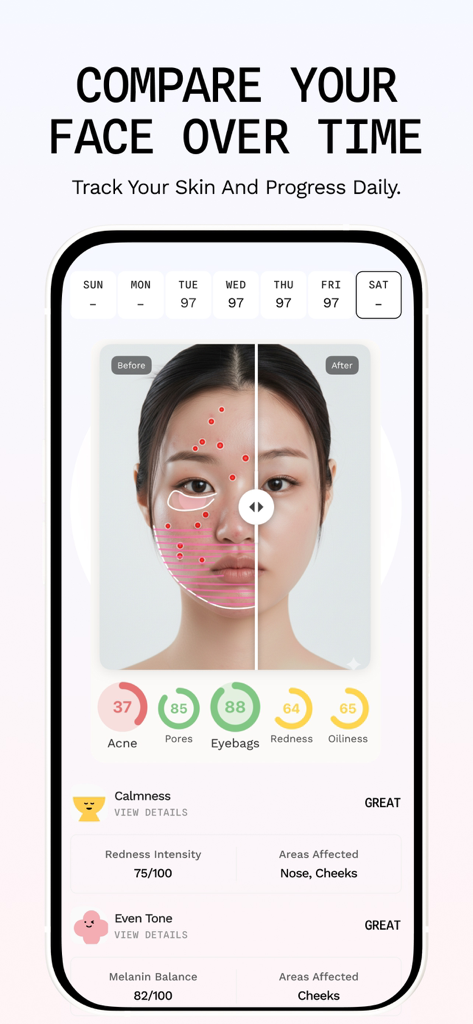 Venus: Personal K-Beauty Coach - Venus app screen showing AI skin analysis and a before and after comparison of facial skin progress