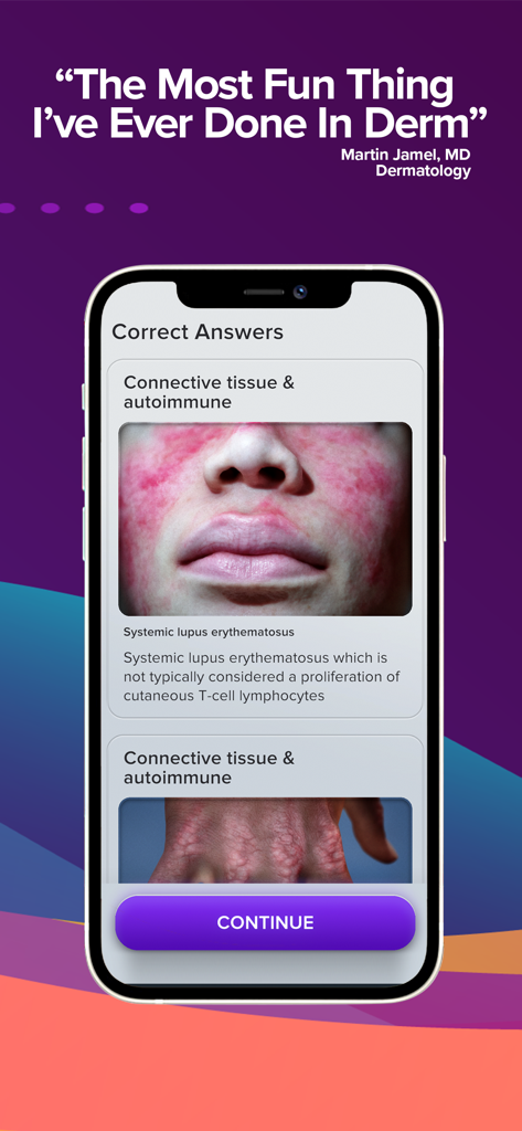 Eine mobile Benutzeroberfläche für die Top Derm App, die richtige Antworten und medizinische Bilder für systemischen Lupus erythematodes zeigt.