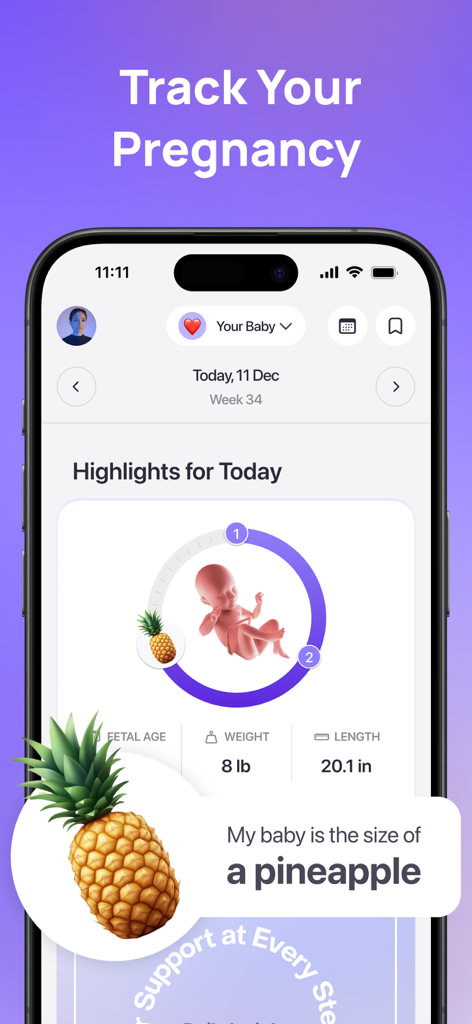Uni - Pregnancy + Baby Growth - Uni pregnancy app interface showing week 34 fetal development and baby size compared to a pineapple