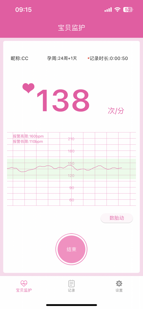 Schermata del monitoraggio del battito cardiaco fetale dell'app Contec Baby che mostra un battito cardiaco di 138 bpm e un grafico visivo
