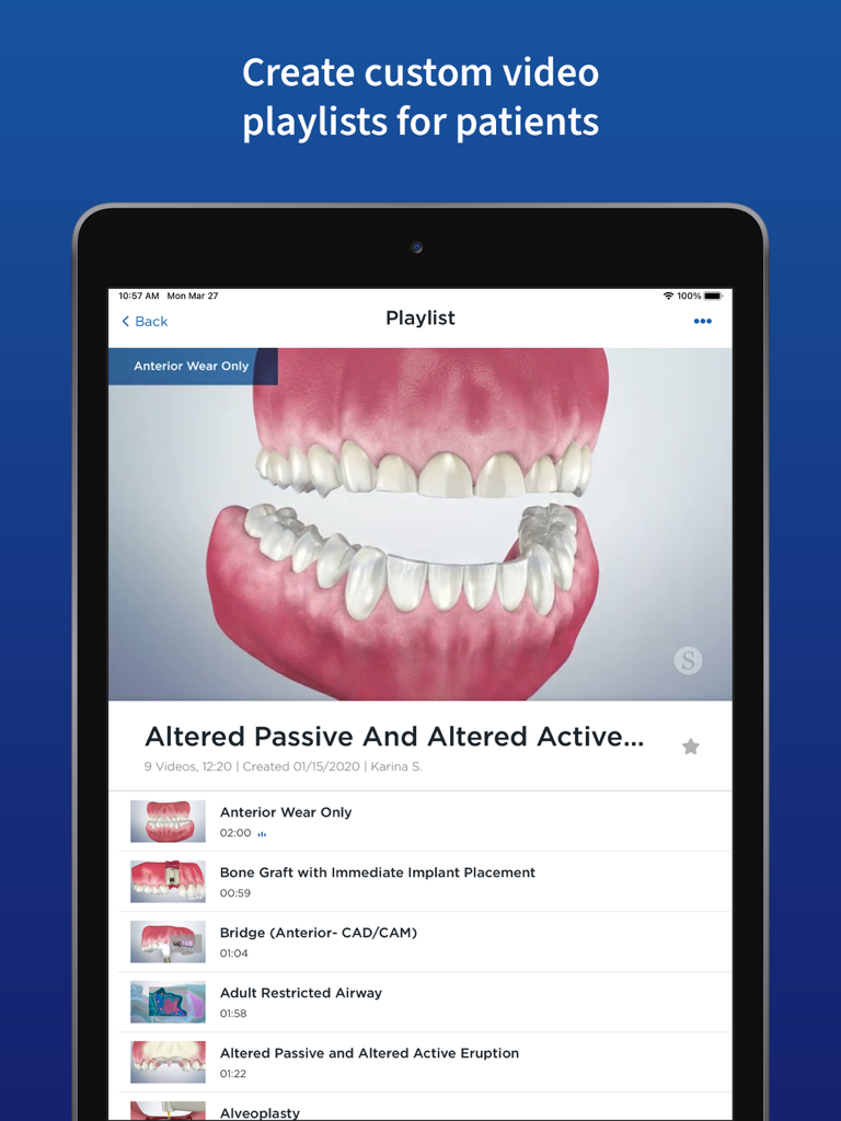 Spear Patient Education - Spear Patient Education app on iPad displaying a custom dental procedure video playlist
