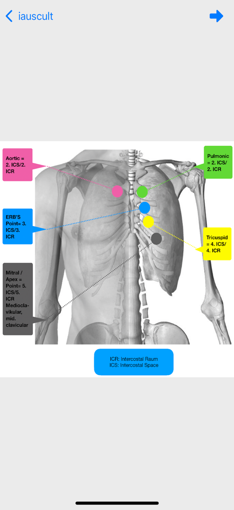 心音聴診ポイント（大動脈、肺動脈、Erb点、三尖弁、僧帽弁を含む）を示す人間の胴体の解剖学的図。色付きのマーカーが付いています。
