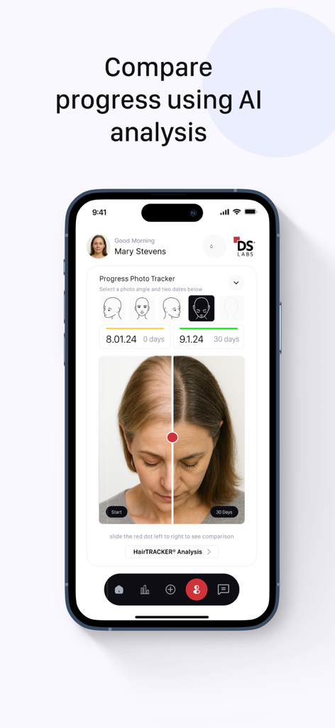 HairTRACK app interface showing a side by side photo comparison of hair growth progress with AI analysis