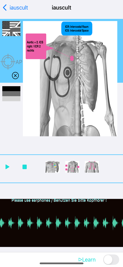 心臓の音のリアルタイムオーディオ波形と聴診器の配置を示す解剖学的胸部図。