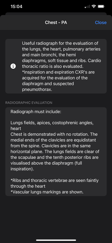 Educational notes for radiographic evaluation of a chest PA X-ray.