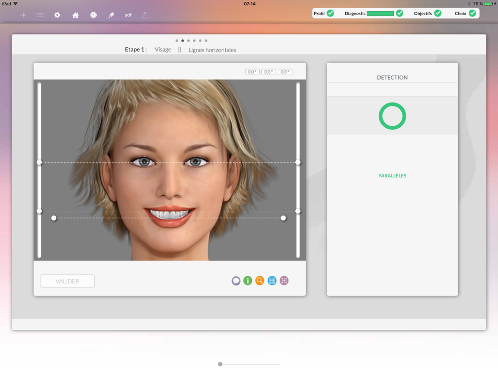 Digital facial symmetry analysis interface showing horizontal alignment lines on a patient for cosmetic dentistry