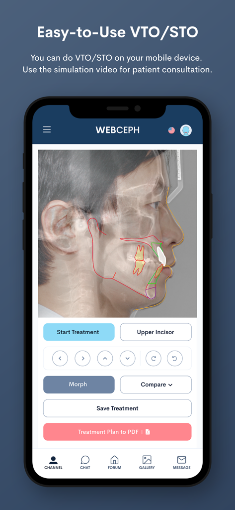 WebCeph - WebCeph mobile app interface showing a VTO and STO orthodontic treatment simulation overlay on a patient profile and X-ray